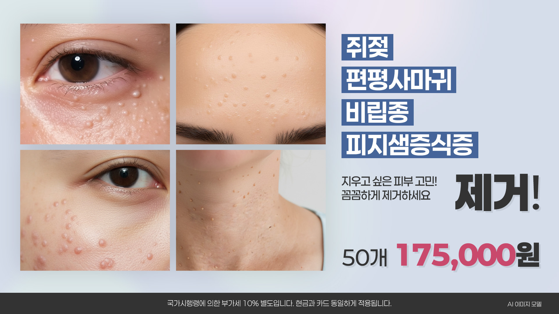 쥐젖 사마귀 제거 프로모션